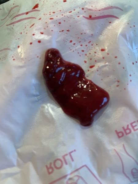 Early Miscarriage Looks Like