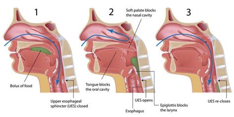 Surface Electrical Stimulation Perturbation Context Determines The