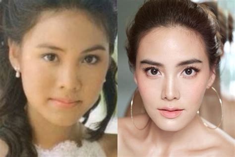 Celebrity Who D From Plastic Surgery In Thailand