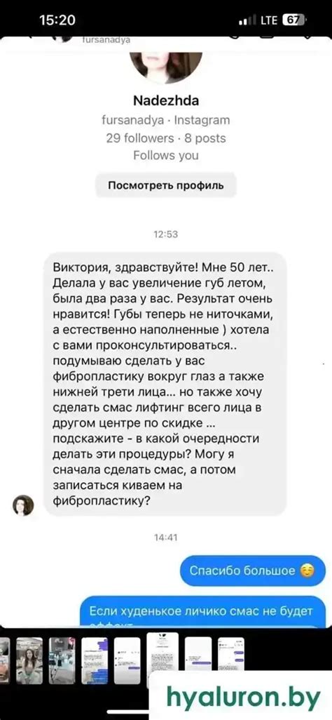 Увеличение губ | БЕЗ боли и инъекций | Эталонная репутация