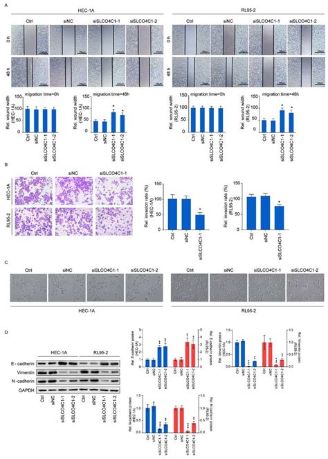 SLCO4C1 Downregulation Suppresses The Migration And Invasion Abilities