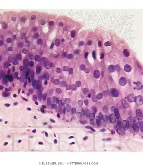 Transitional Epithelium Labeled Basement Membrane