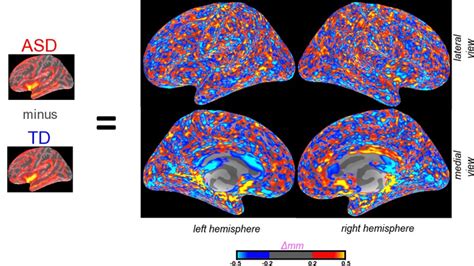 AUTISM BRAIN ORIGINS-ENVIRONMENT AND PHYSIOLOGY REALLY MATTER - Autism ...