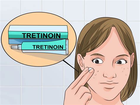 how long for tretinoin to work 3