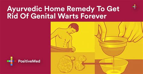 Ayurvedic Home Remedy To Get Rid Of Genital Warts Forever