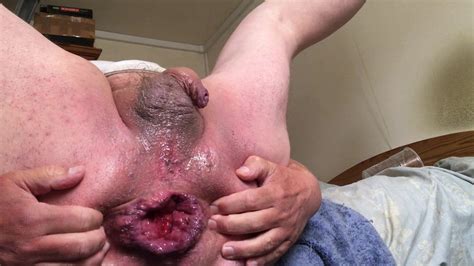 Anal Klaffende Session Mit Flasche Und Eis Xhamster