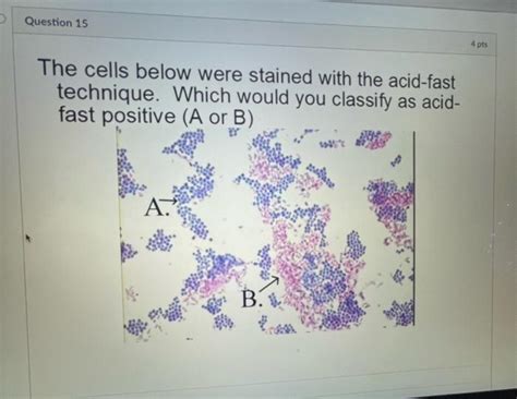 solved  cells   stained   acid fast cheggcom