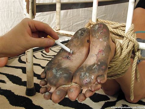 Cigarette Dirty Foot Torture Porn Pictures XXX Photos Sex Images PICTOA