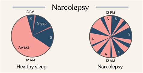 Learn About Narcolepsy – Somn