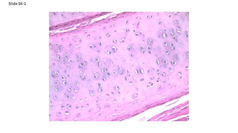 Hyaline Cartilage Diagram Quizlet