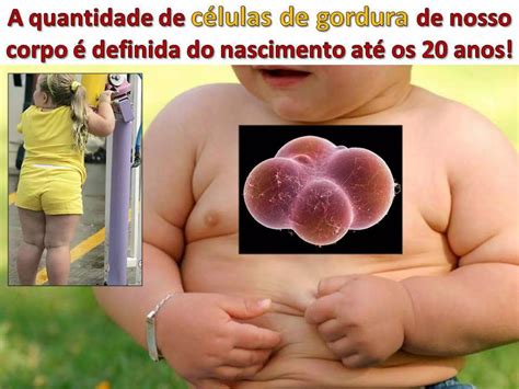 Os Grandes Riscos Da Obesidade Infantil PPT