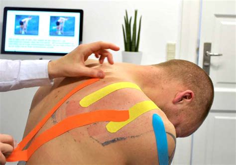 Kinesio Bantlama Zel Mersin Fizyomed Fizik Tedavi Ve Rehabilitasyon