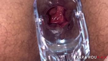 Anal Vision Speculum XVIDEOS