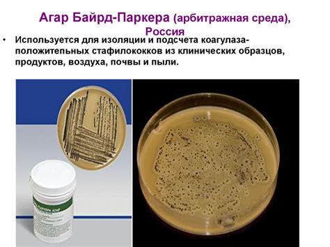 Пиогенные (гноеродные) бактерии - презентация онлайн