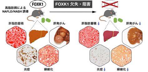 ⾮アルコール性脂肪性nashの病態に関わる新たな因⼦を発⾒～肥満から進⾏する肝硬変・肝がんの新たな予防法・治療法開発に期待～ テック