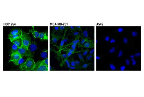 PD-L1 (Extracellular Domain Specific) (D8T4X) Rabbit mAb (Alexa Fluor ...