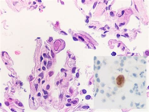 How Do Primary Cells Differ From Continuous Cell Lines? | Kosheeka