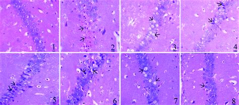 Pathological changes in hippocampus CA1 among the groups (H and E ...
