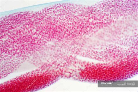 Dog roundworm eggs (Toxocara canis), light micrograph. — nature, white ...