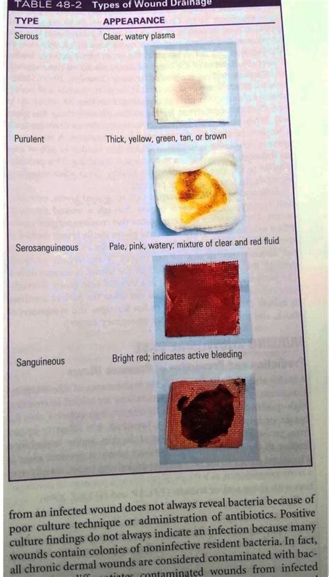 Types Of Wound Drainage
