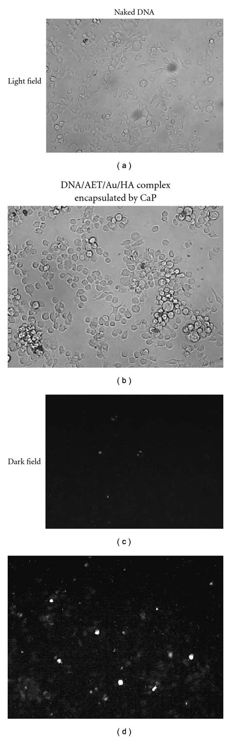 Cellular Uptake Of Fluorescence Labeled Naked Dna And Its Complex With