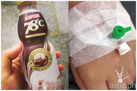 Girl Drinks 2 Bottles Of Kopiko 78 Palpitates Afterwards And Was