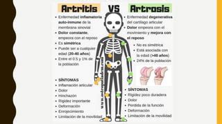 Artritis Y Artrosis Ppt