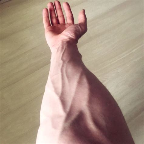 Veins On The Hand Aesthetics