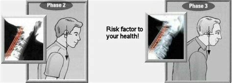 relationship  posture  health