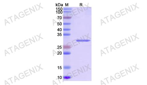 Recombinant Human DTNBP1 N His价格 Recombinant Human DTNBP1 N His厂家 武汉普健生物