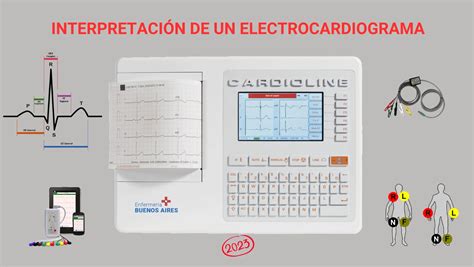 Interpretación de un Electrocardiograma 2024