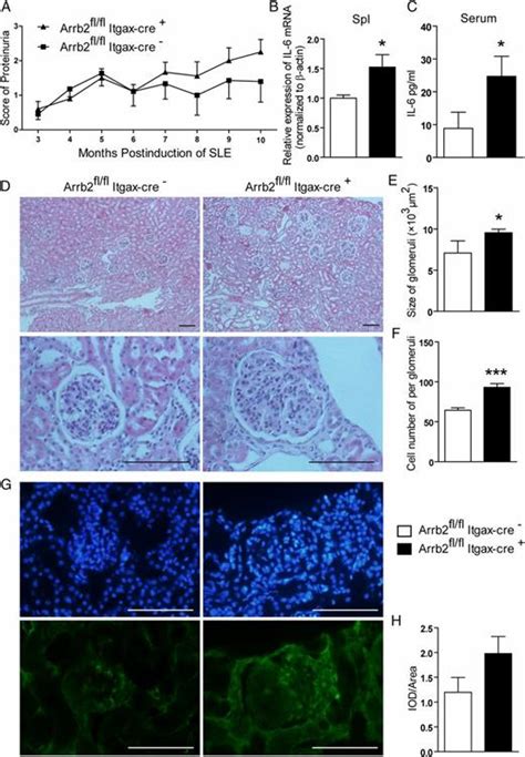 Deficiency Of β Arrestin 2 In Dendritic Cells Contributes To Autoimmune