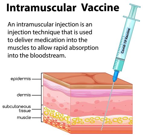 information vector  intramuscular injection  vector art