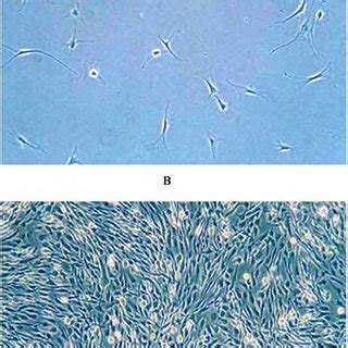 photomicrophotograps  representative human tendon cell cultures