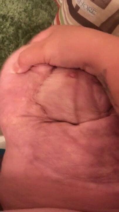 Amputee Stump Free Amputee HD Porn Video D XHamster