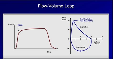 Spirometry and Flow-Volume Loops | Time of Care