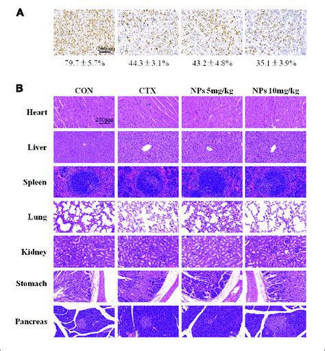 Immunohistochemical Ihc Analysis Ihc Analyses Of Tumors A And