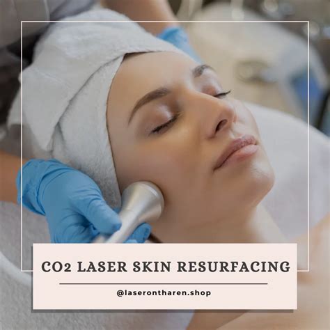 Co2 Laser Skin Resurfacing Complete Guide Laser Ontharen