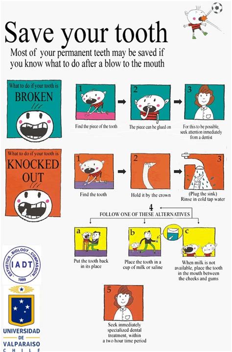 Knocked Out Baby Tooth Anchorage Pediatric Dentistry