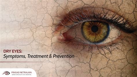 What Does Brown Spots On Eyes Mean - Infoupdate.org