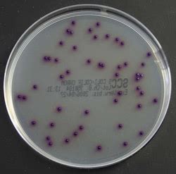 Thermo Scientific Agar Selectivo De Coliformes E Coli Brilliance