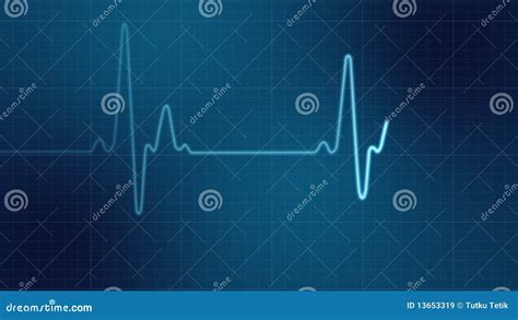 EKG heart monitor stock illustration. Illustration of medicine - 13653319