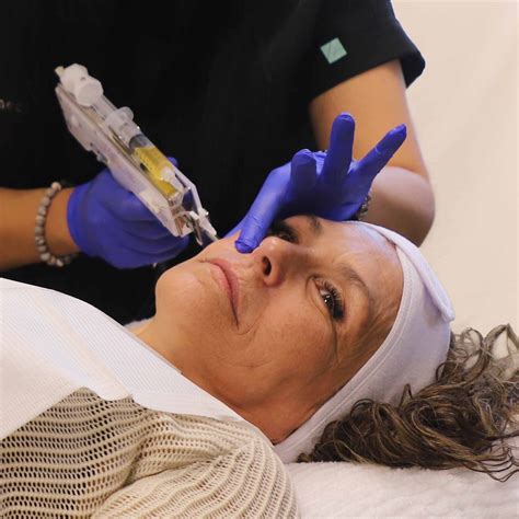 Prp Visage Injections De Plasma Riche En Plaquettes Medicart