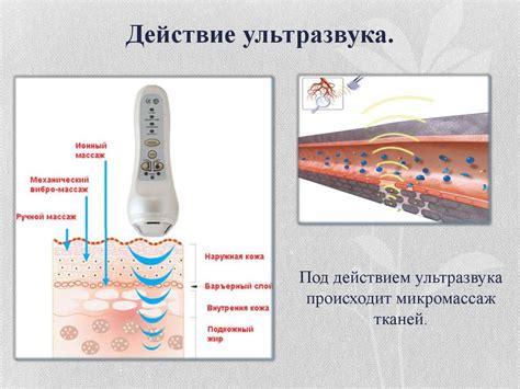 Ультразвук в медицине - презентация онлайн