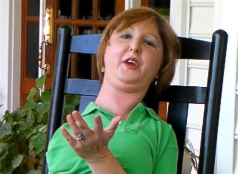 The Living Statue Amazing Story Of Woman With Rare Disease Videos