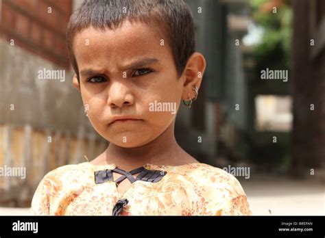 Malnourished Child In Refugee Camp Hi Res Stock Photography And Images