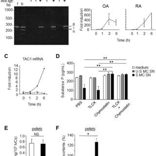 Different Staining Patterns Of Sp And Tryptase In Synovial Mcs From Oa