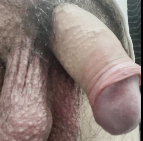 My Uncut Foreskin Play Gay Uncut American Porn 43 XHamster XHamster