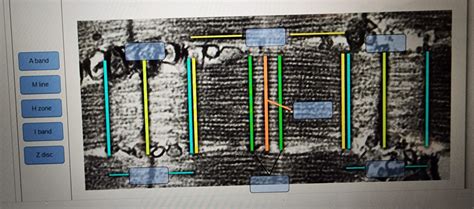 Solved Identify The Regions Of The Sarcomere Note That L