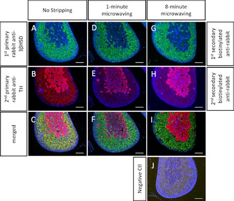 Microwaving And Fluorophore Tyramide For Multiplex Immunostaining On